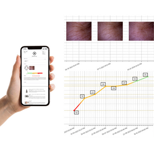 Hydration, pH, and Elasticity: Why Measuring Skin Health Parameters Matters More Than Ever