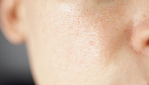 The Science Behind Visible Pores
